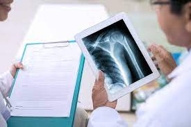 X Ray Services